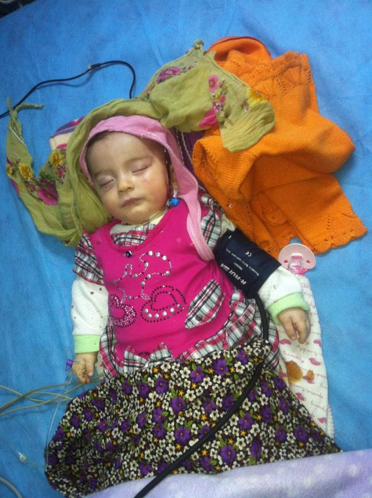Ayşenur Bebek Tedavi Altında