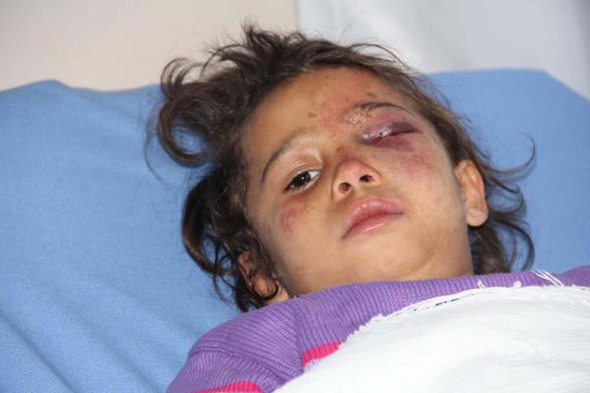 7 Yaşındaki Kızını Döverek Hastanelik Ettiği İddiasıyla Babaya Gözaltı
