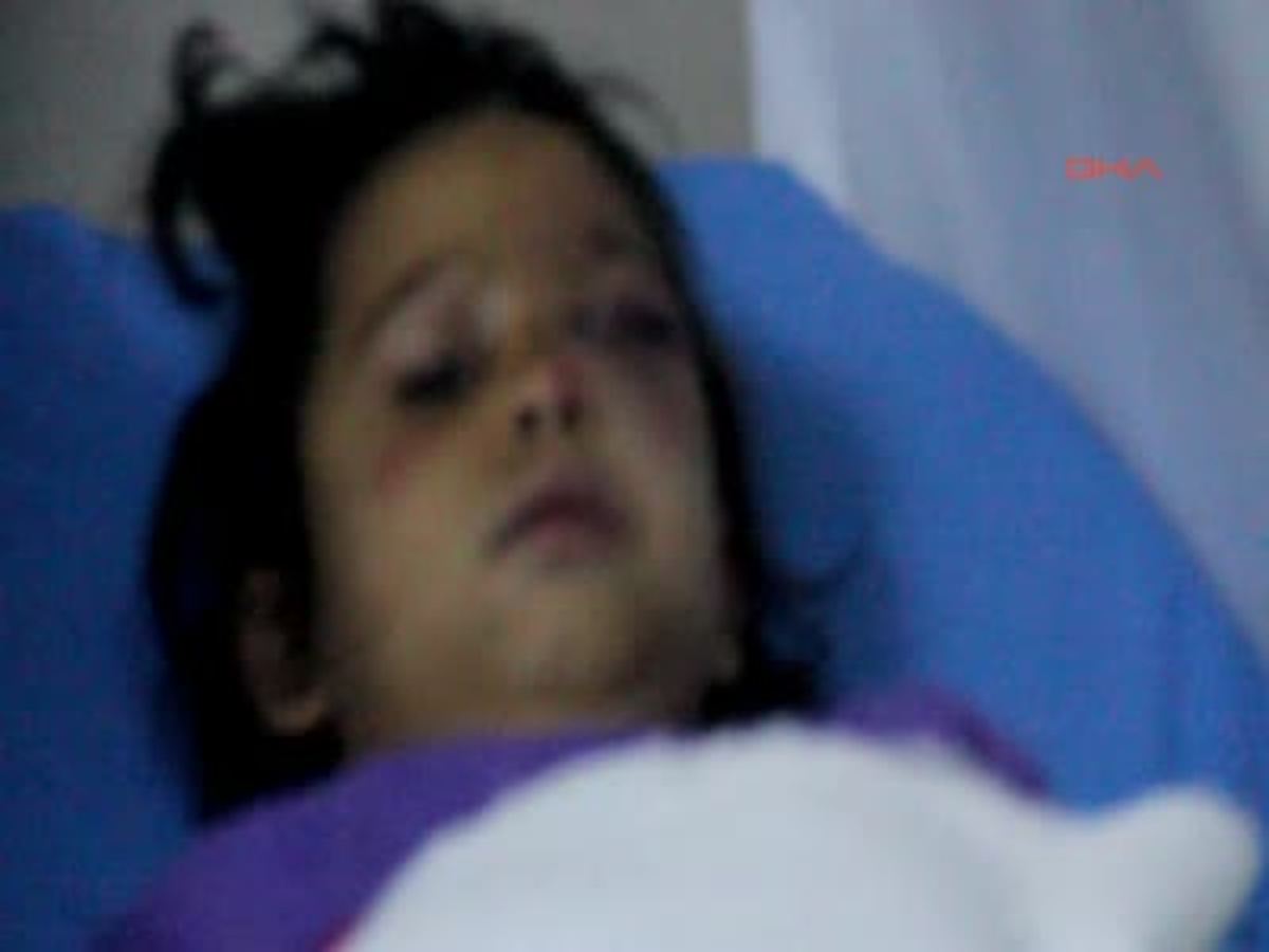 Nazilli 7 Yaşındaki Kızını Döverek Hastanelik Etti 7 Yaşındaki Kızını Döverek Hastanelik Etti