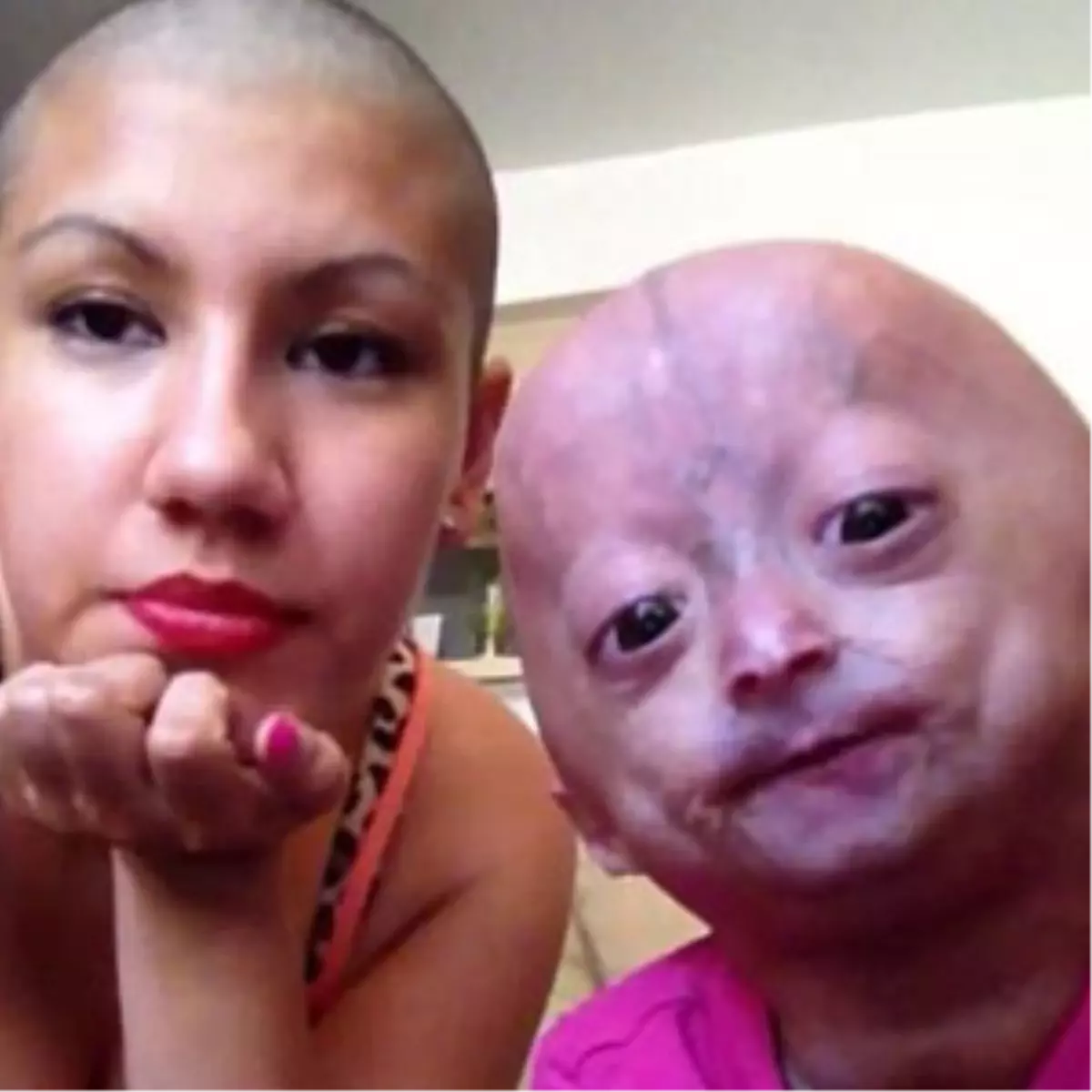 13 Yaşında Ölecek!