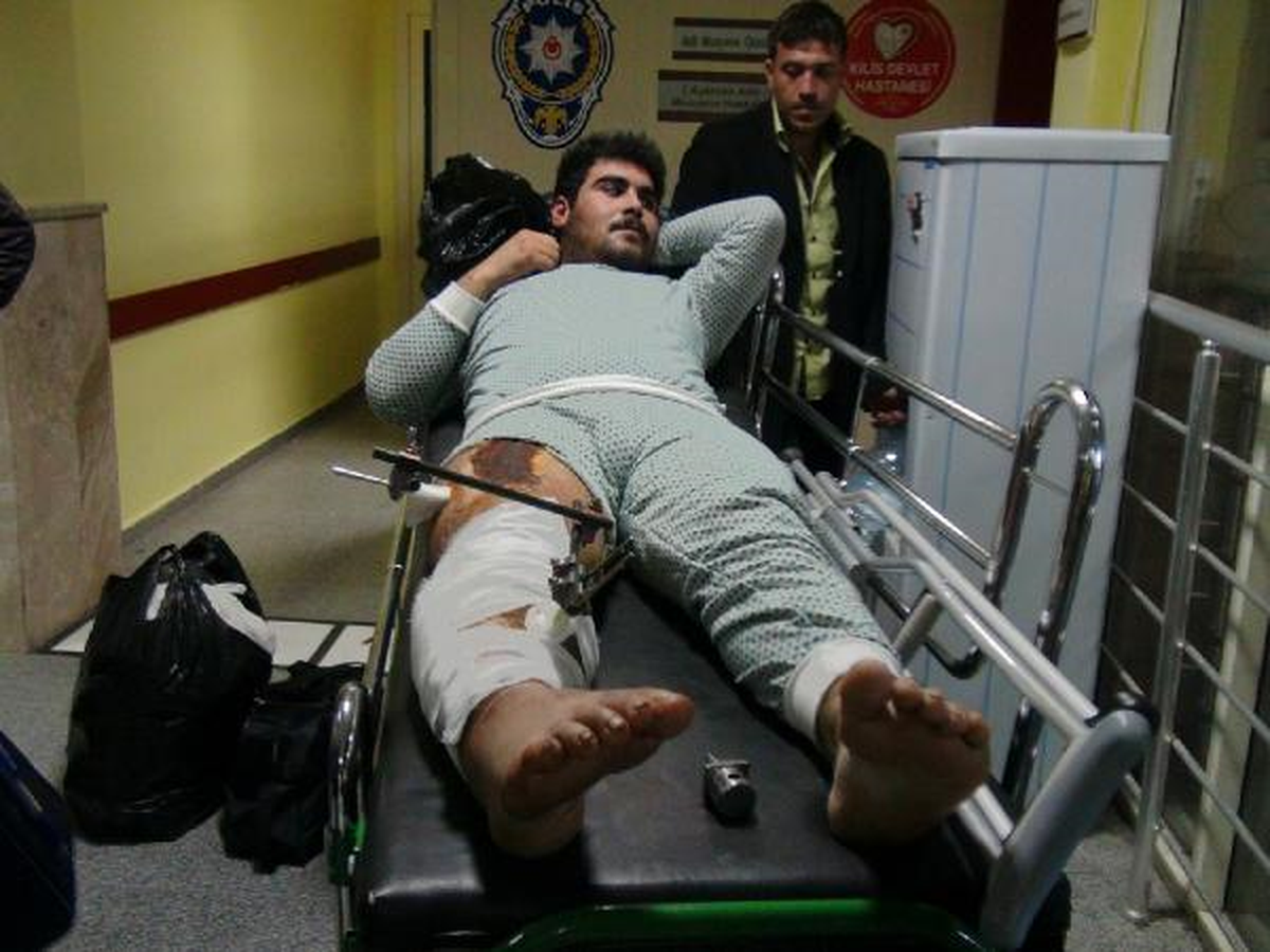 Suriye\'den Gelen 12 Yaralıdan Biri Öldü