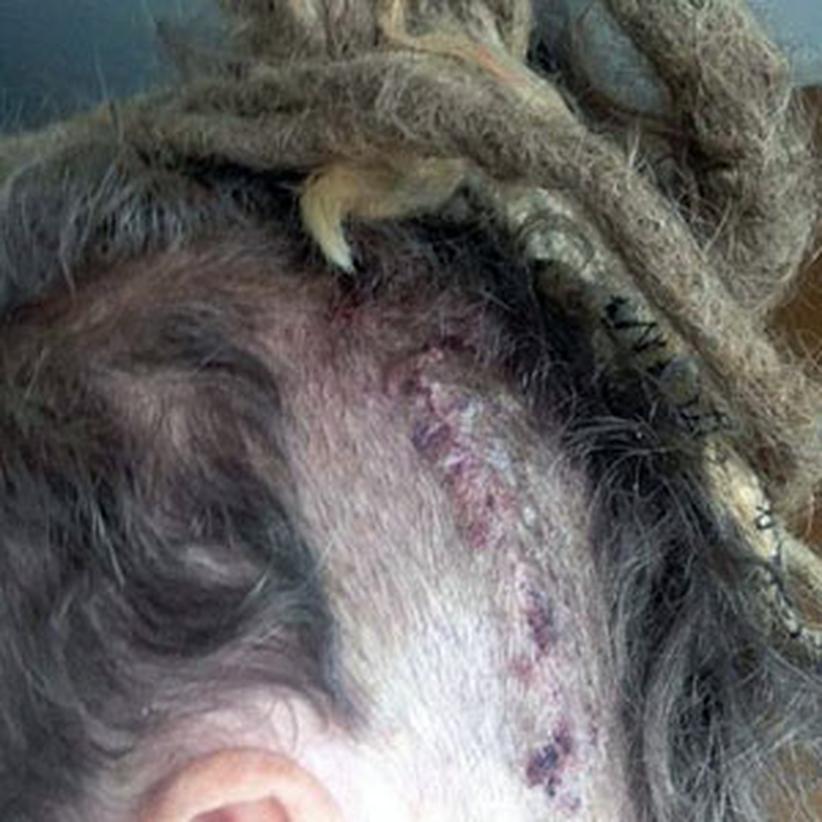 Beyninden Tenya Çıktı