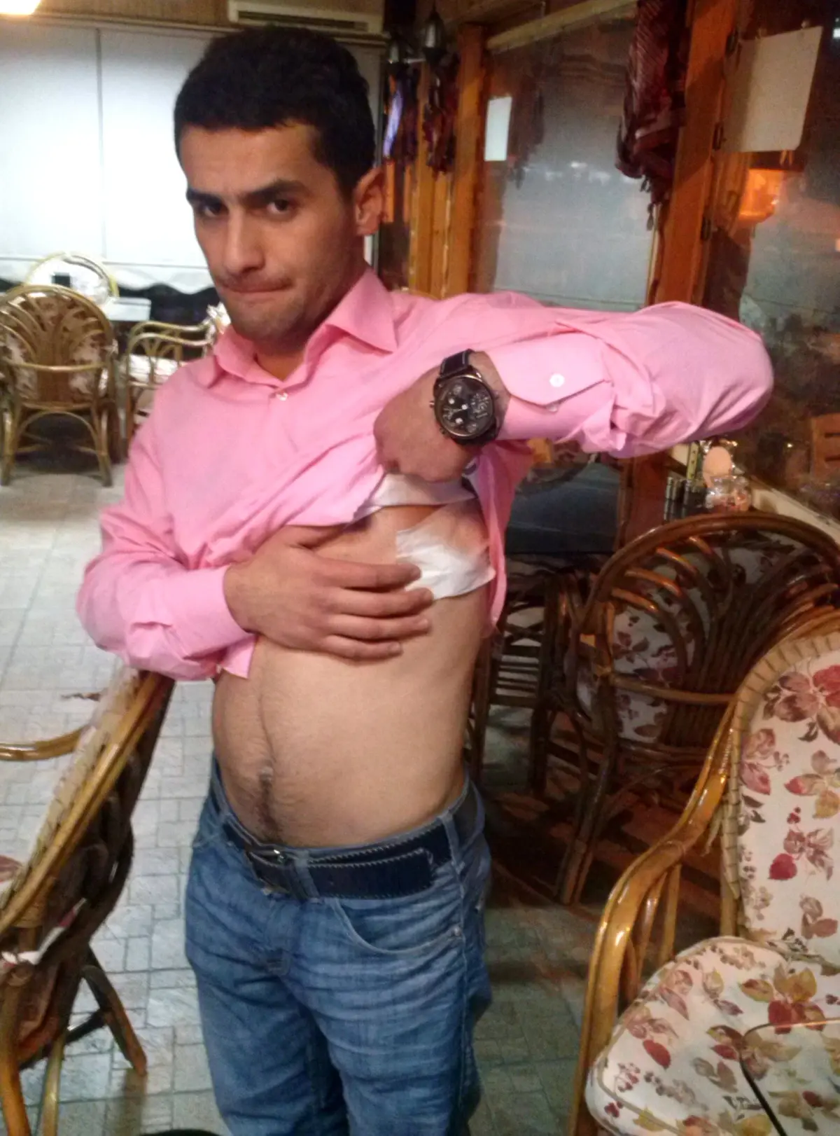 Üst Devre Dayağı Hastanelik Etti