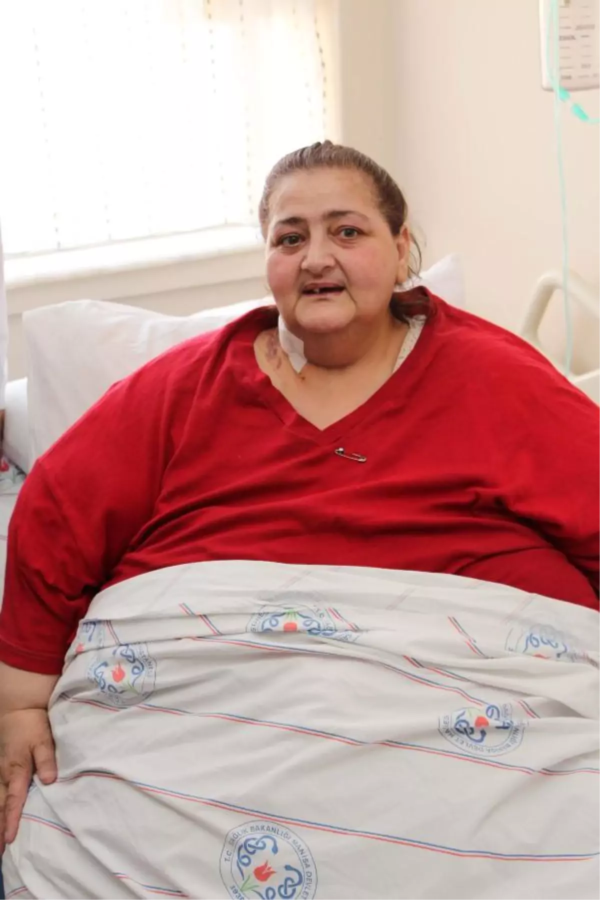 Manisa'da Obezite ile Mücadeleye Poliklinik