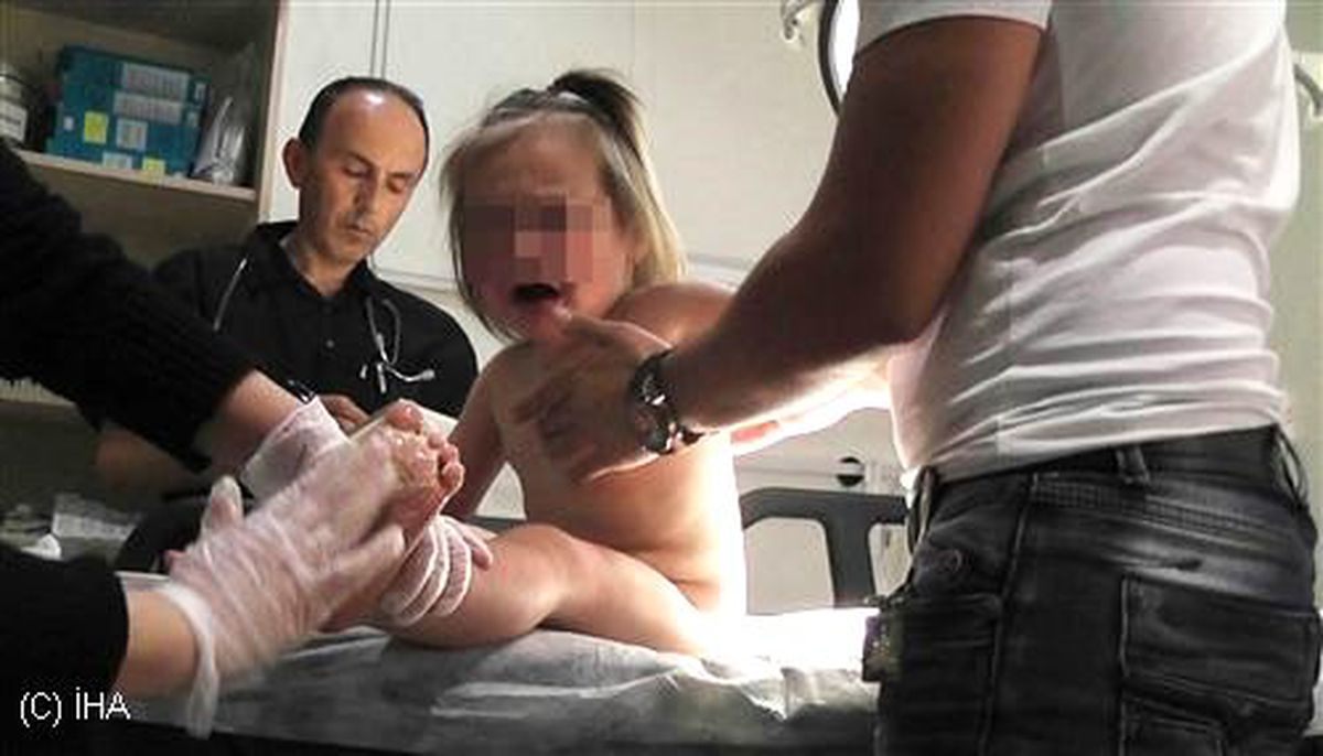 Küçük Kızın Vücudunda Sigara Söndürdüler