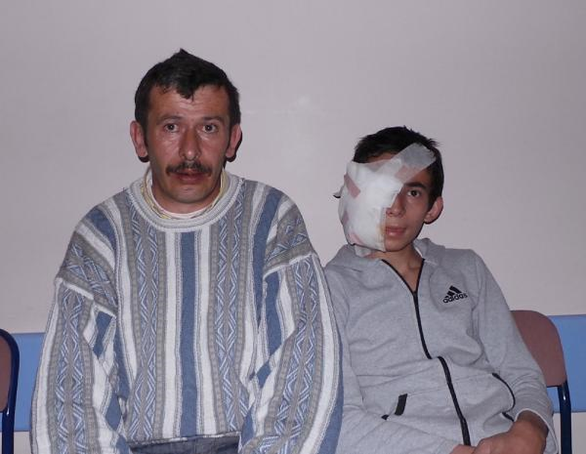 Torpille Oynarken Gözünden Yaralandı