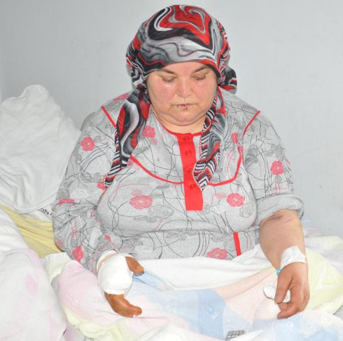 Niğde\'de Bir Kadının Oya İğnesi Batan Parmağını Kestiler