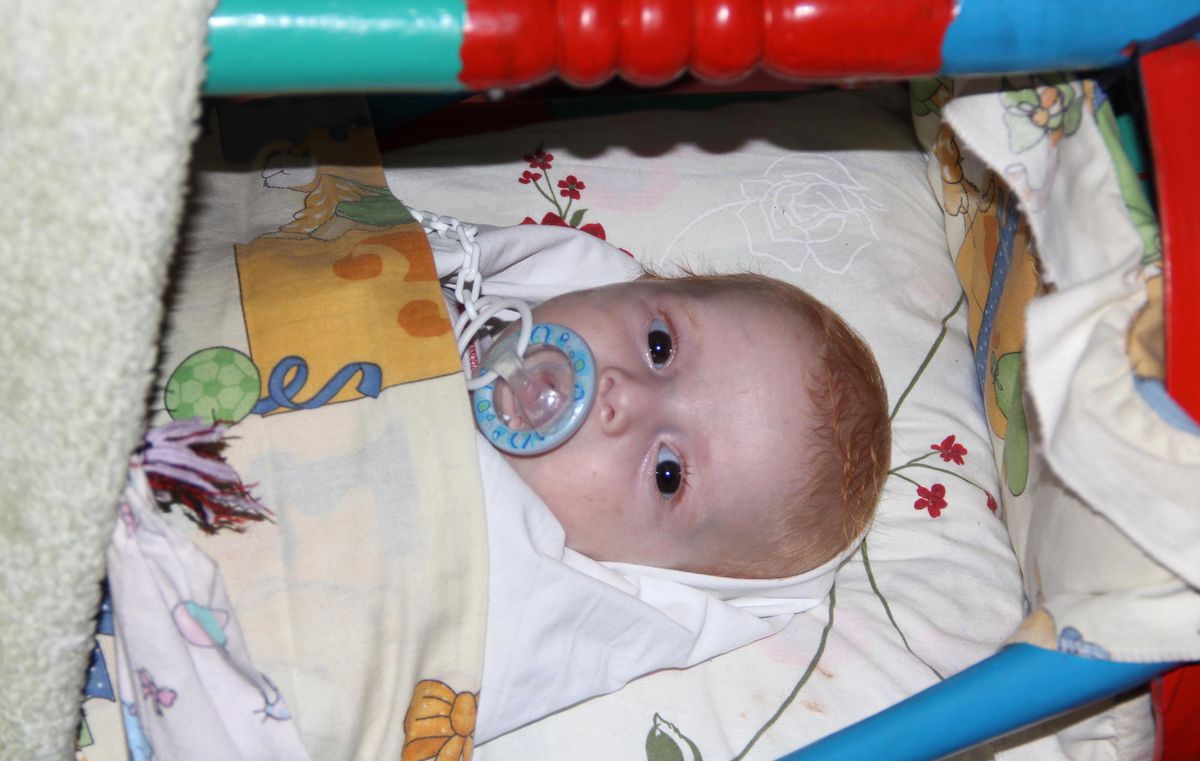 Üç Yaşındaki Berat Günden Güne Eriyor