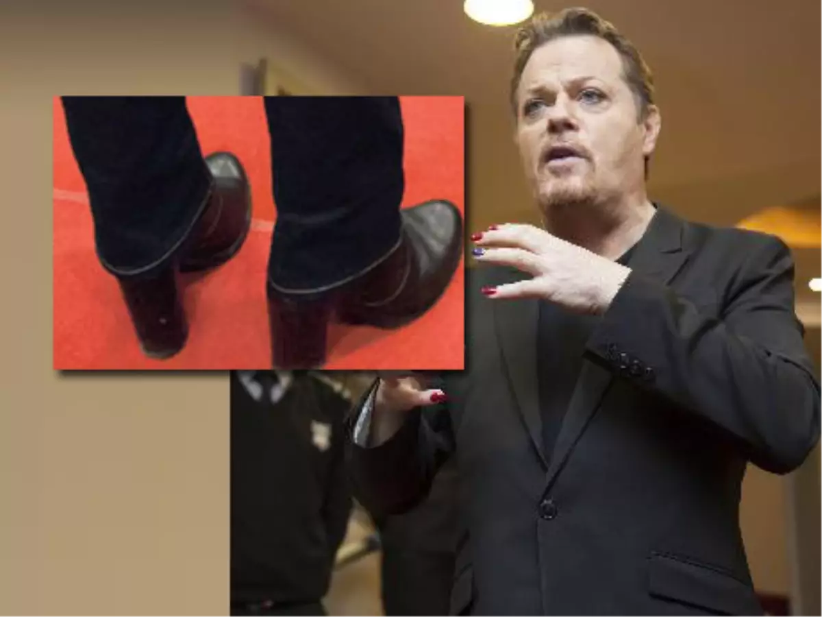 Eddie Izzard Ojeleriyle Şaşkına Çevirdi