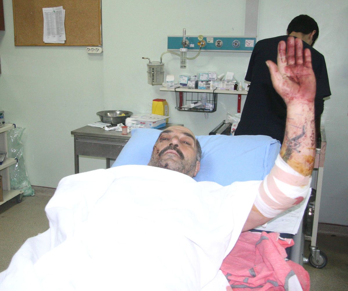 Suriye\'den Kilis\'e Getirilen 14 Yaralıdan 2\'si Hayatını Kaybetti
