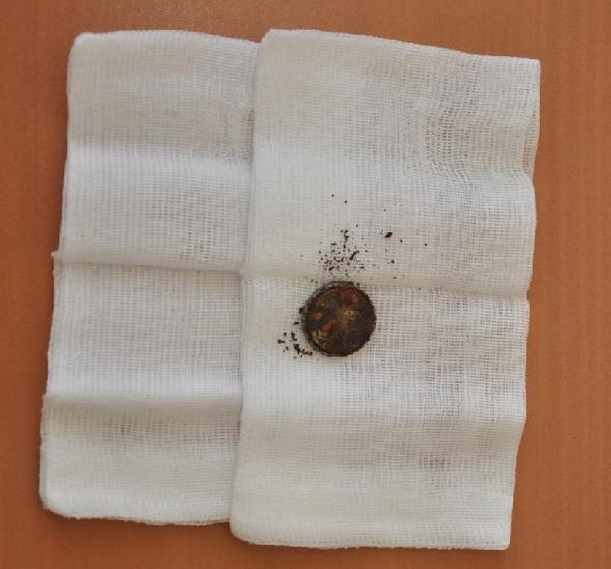 Boğazına Yapışan Pil Ameliyatla Çıkartıldı
