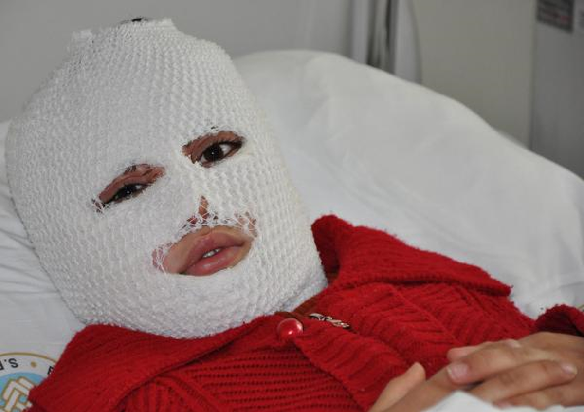 Piknikte Ateşin Üzerindeki Teneke Patladı