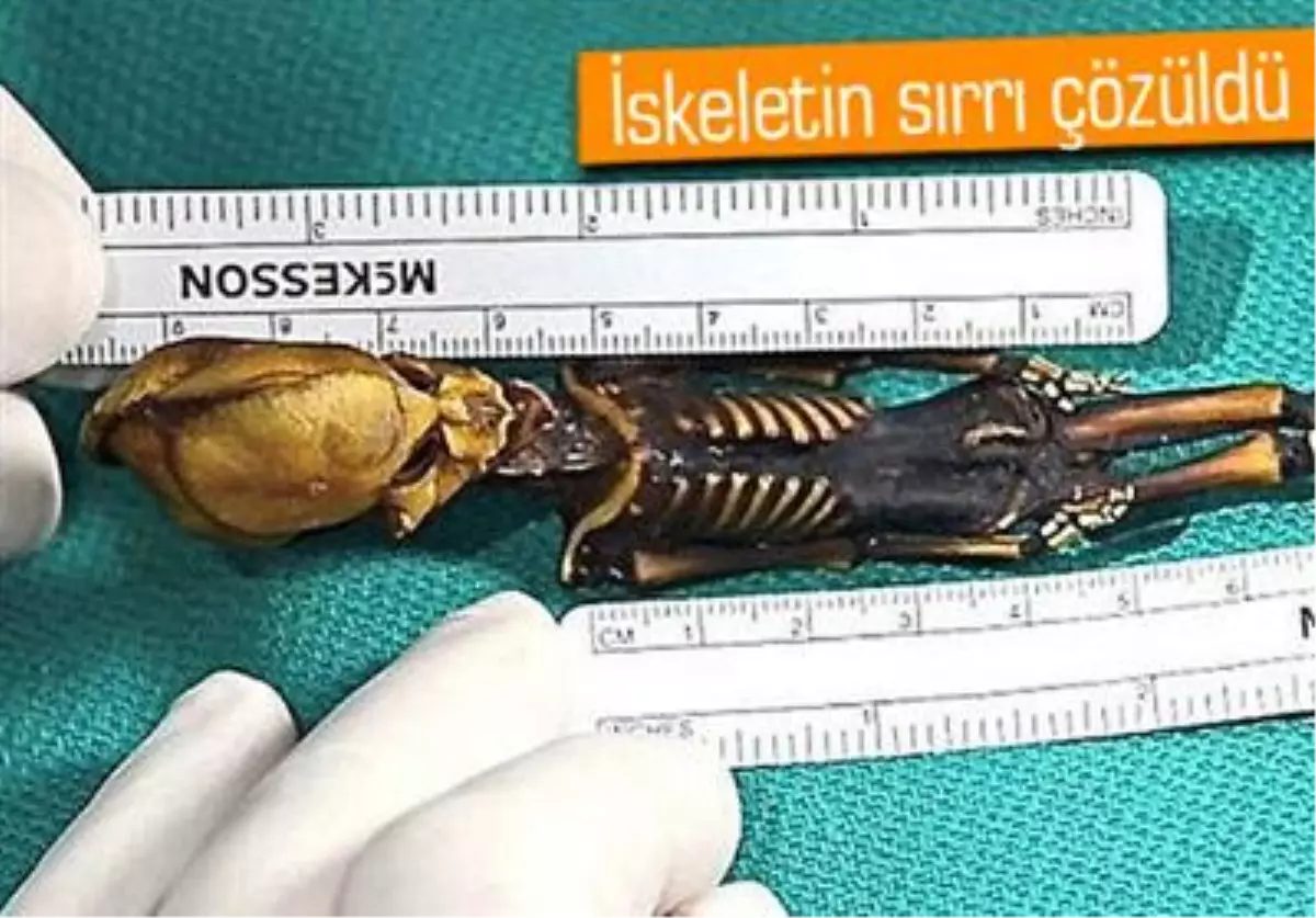 15 Santimlik İskelet İnsana Aitmiş