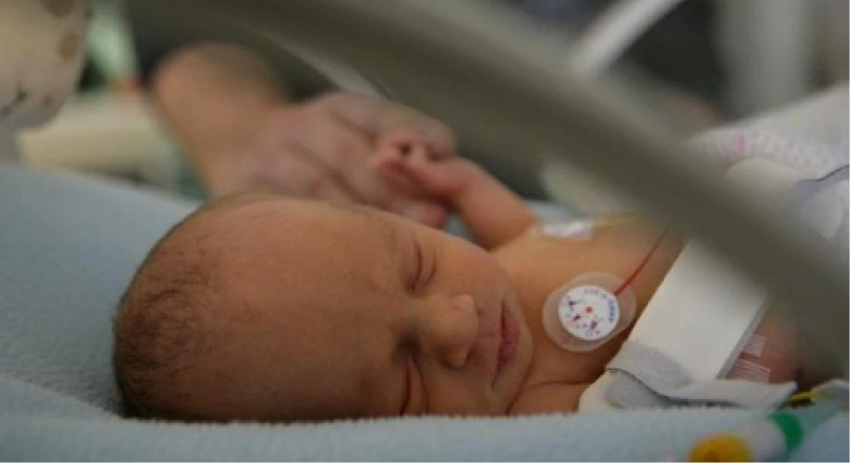 6 Bin Bebek Kalp Ameliyatı Bekliyor