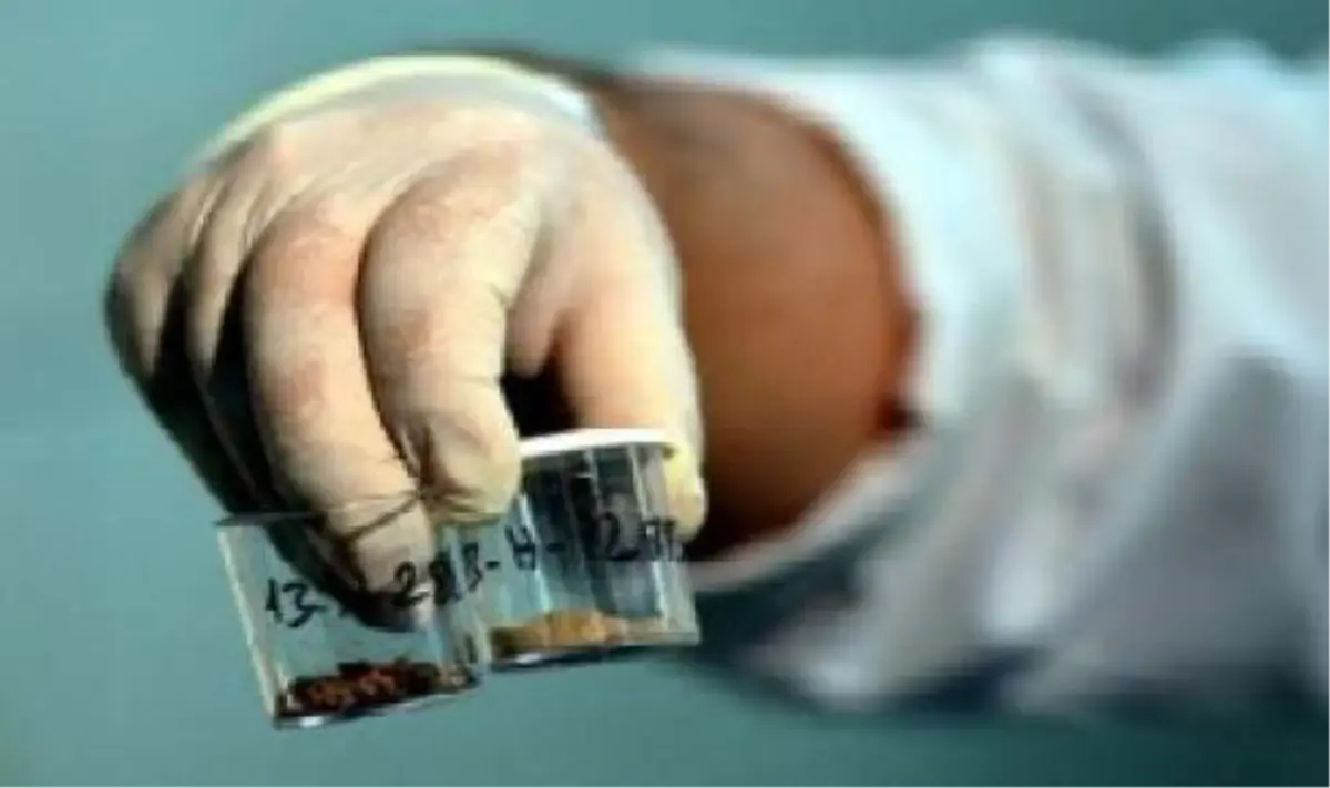 Mta Yılda 3 Bin Böbrek Taşı İnceliyor