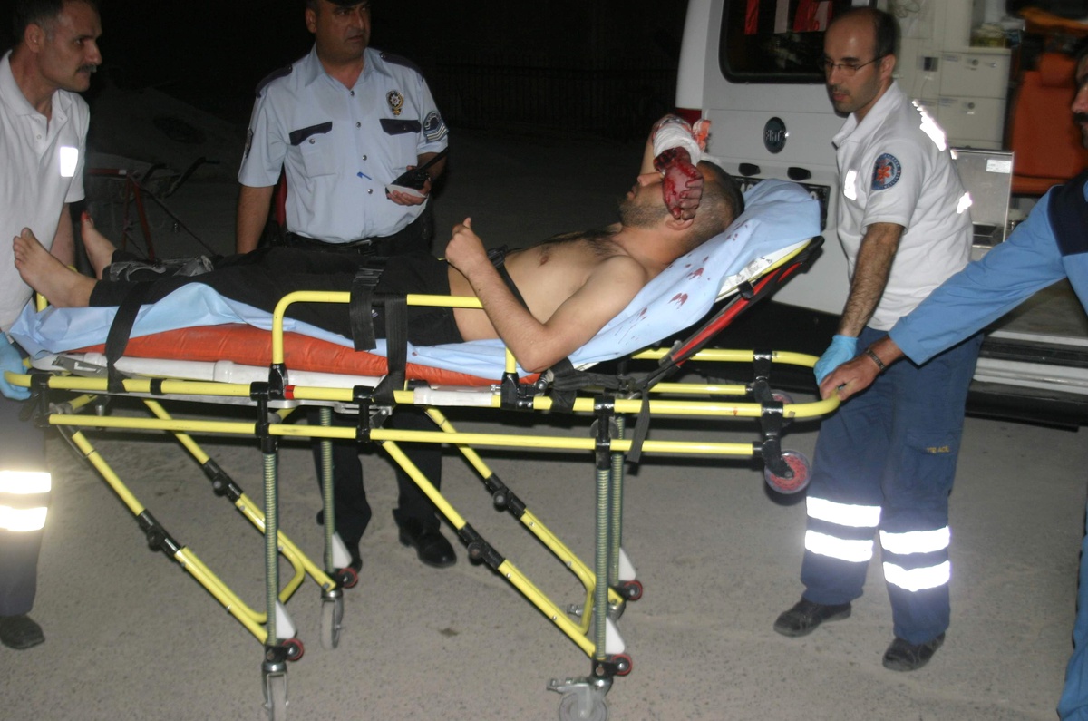 Hırsız, Parke Taşıyla Kırdığı Camda Kolunu Kesti