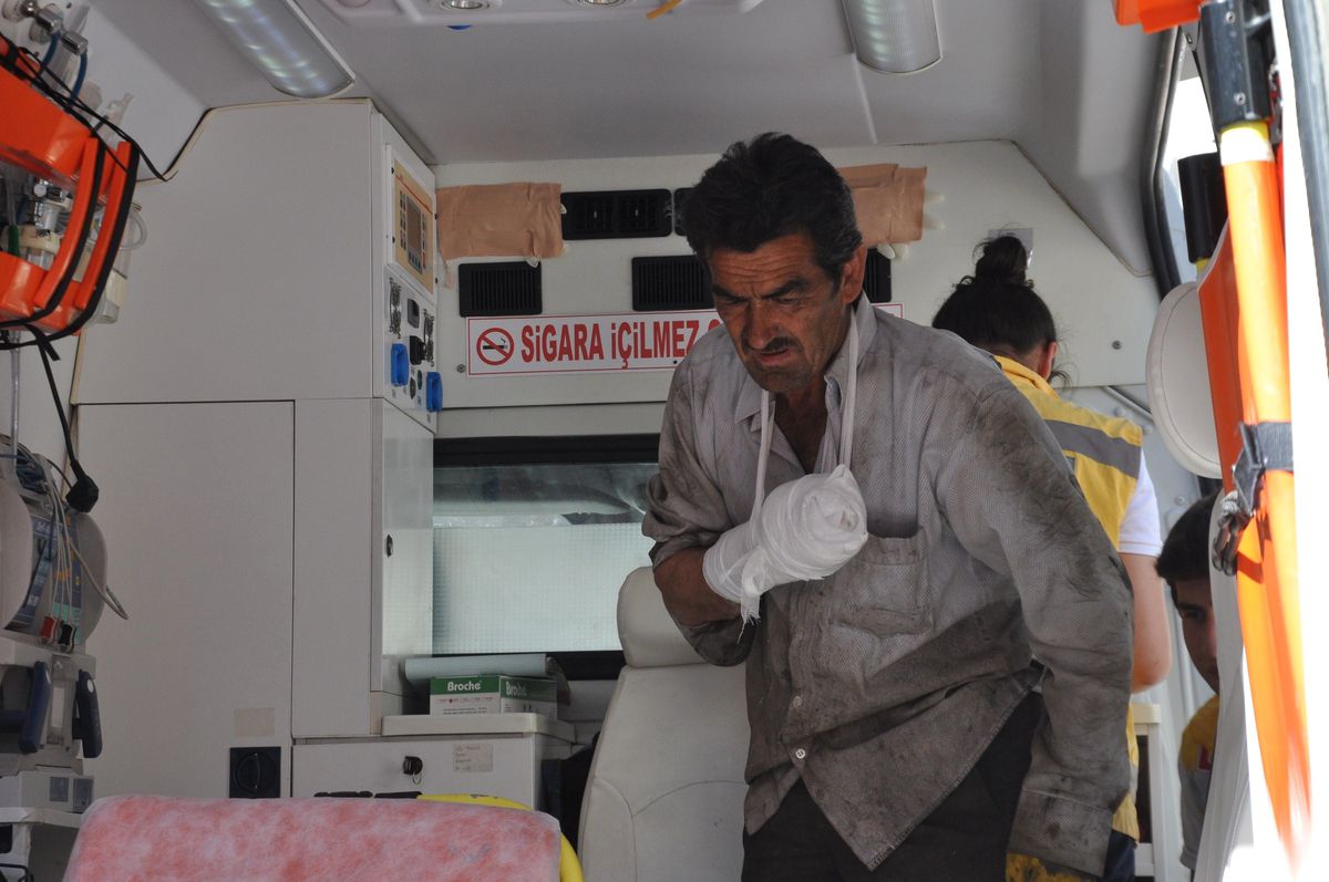 Prese Elini Kaptıran Şahsın Parmakları Koptu