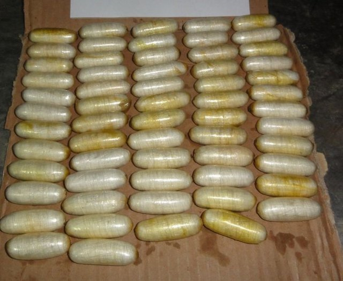 Cinsel Organında ve Midesinde Uyuşturucu Çıktı