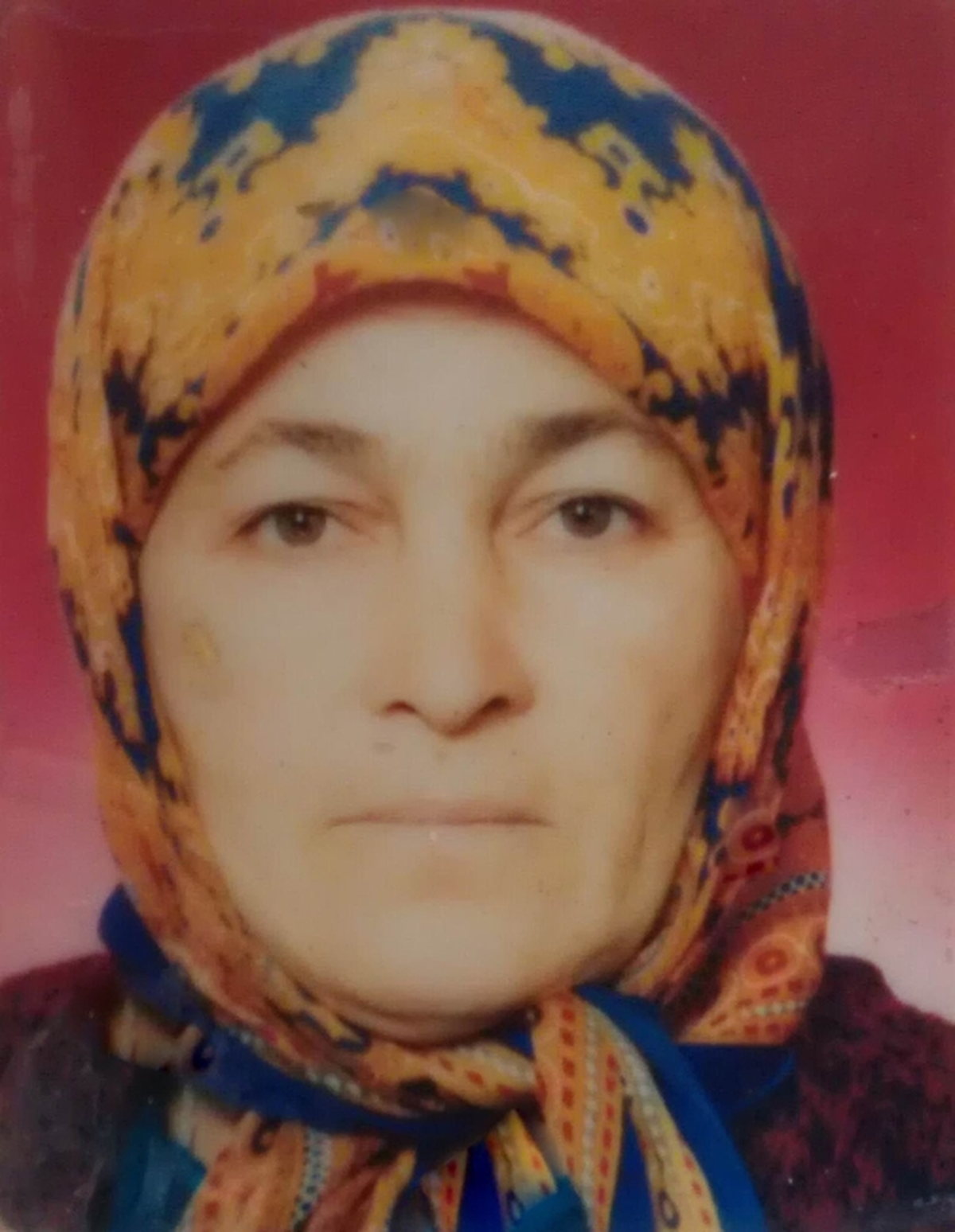 Kuzineyi Yakarken Eteği Tutuşan Kadın Öldü