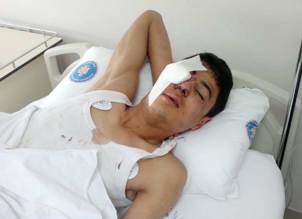 Gaz Bombasıyla Kör Olan Vedat Oğuz Konuştu
