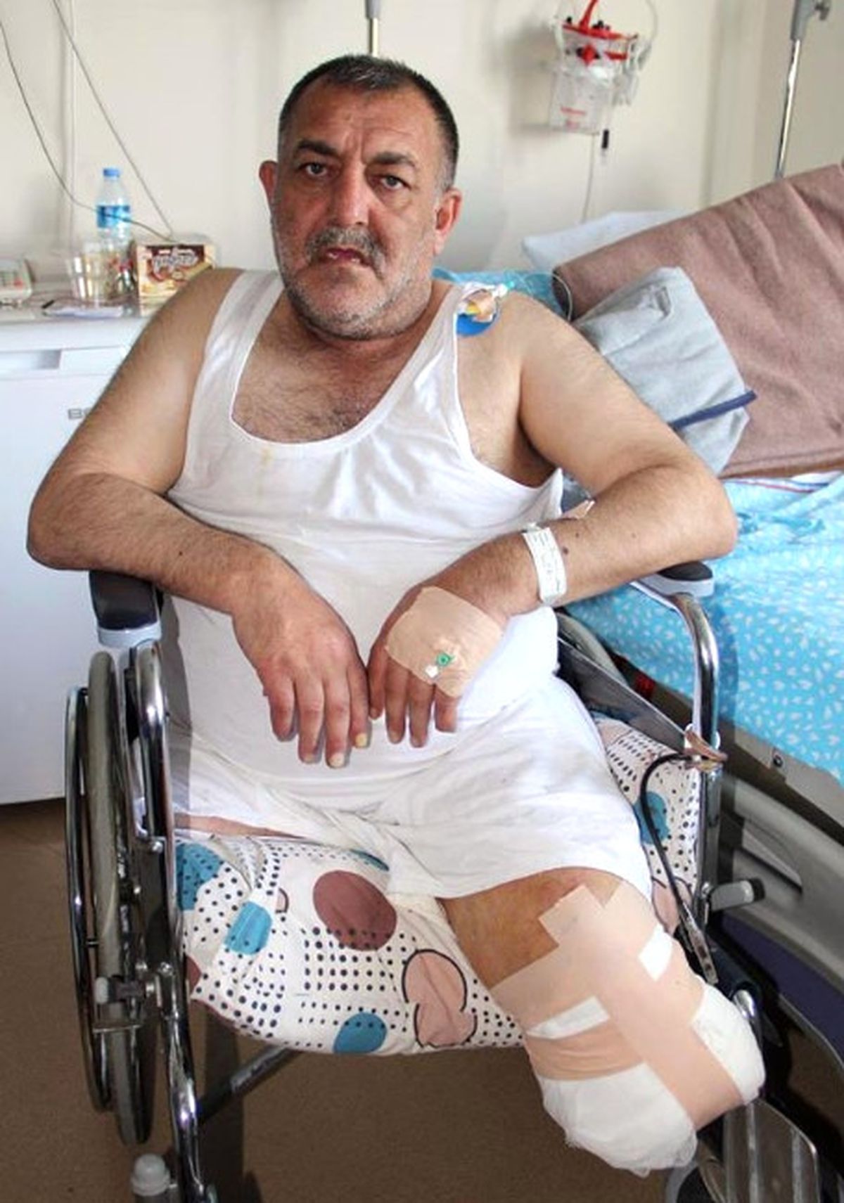 Sigara Onu Parça Parça Götürüyor