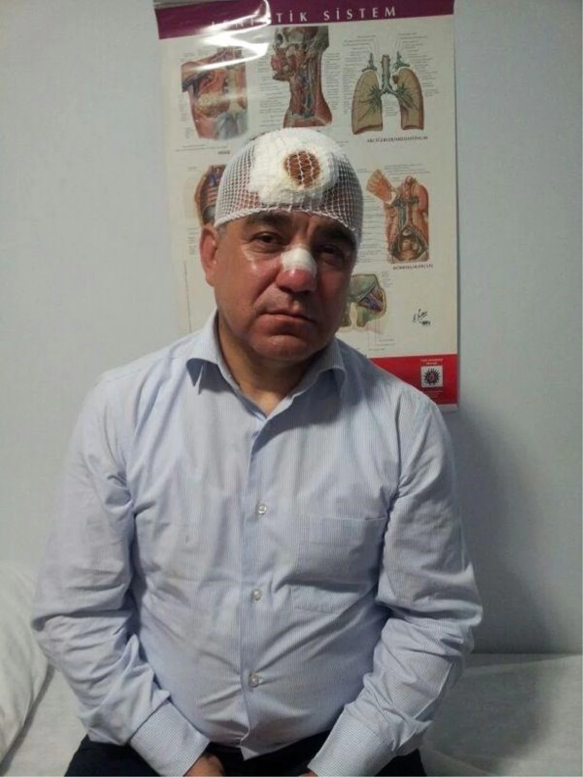 CHP Milletvekili Topal: Arbedede Burnum Kırıldı