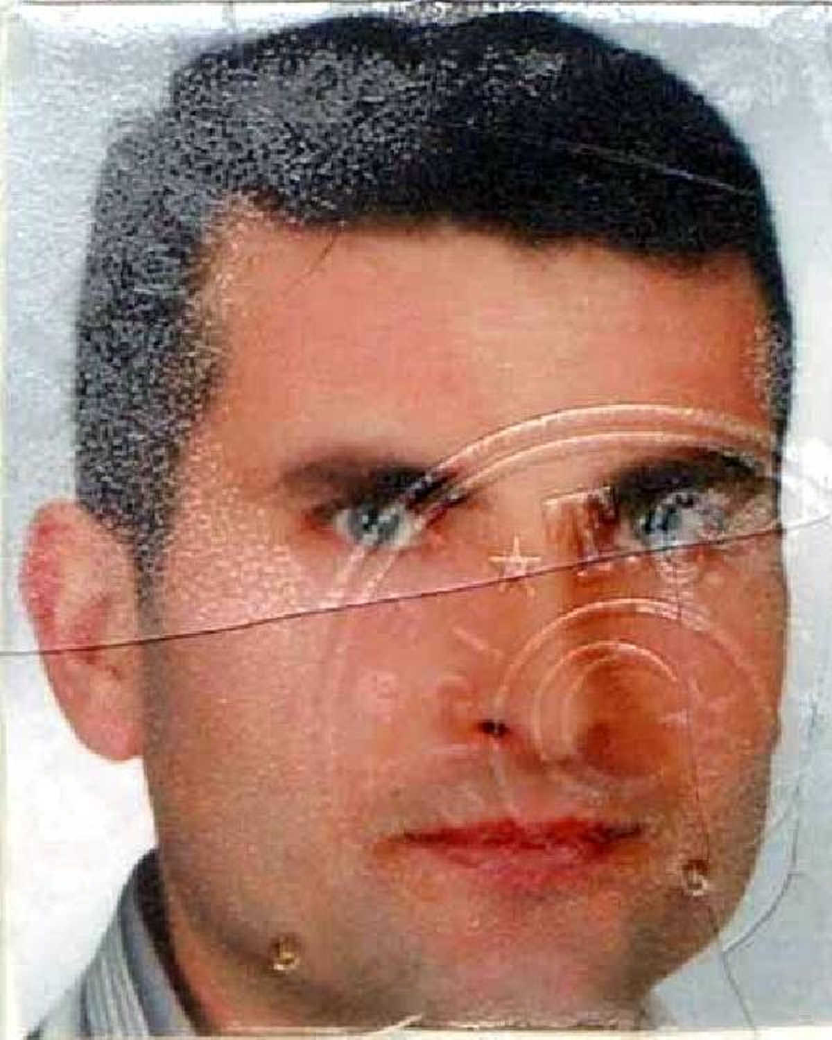 Kavgadan 25 Gün Sonra Öldü