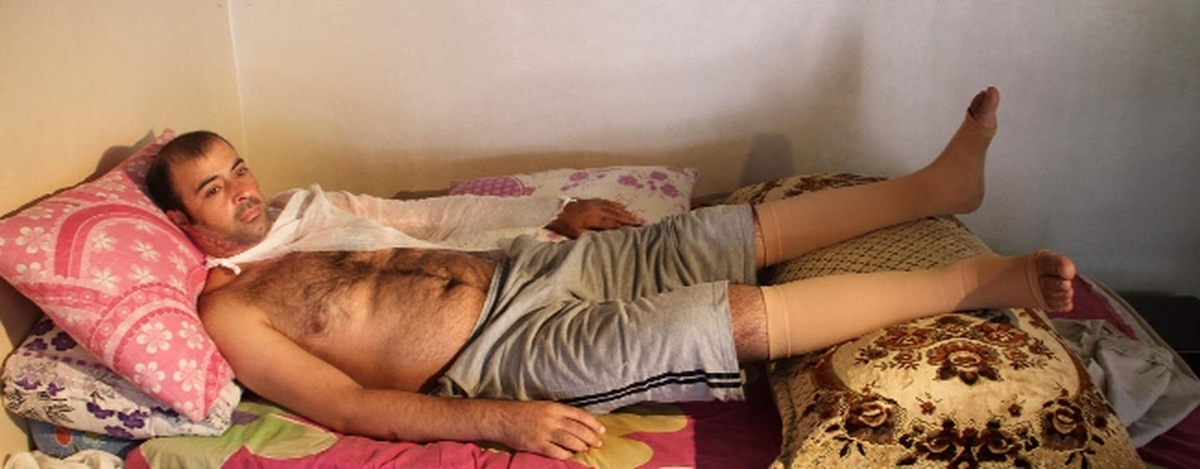 12 Metreden Düştü, Hayatta Kalmayı Başardı