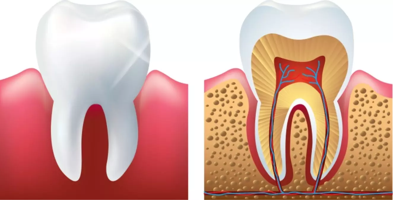 Hassas Dişlerin Koruma Kalkanı "DentaSave"