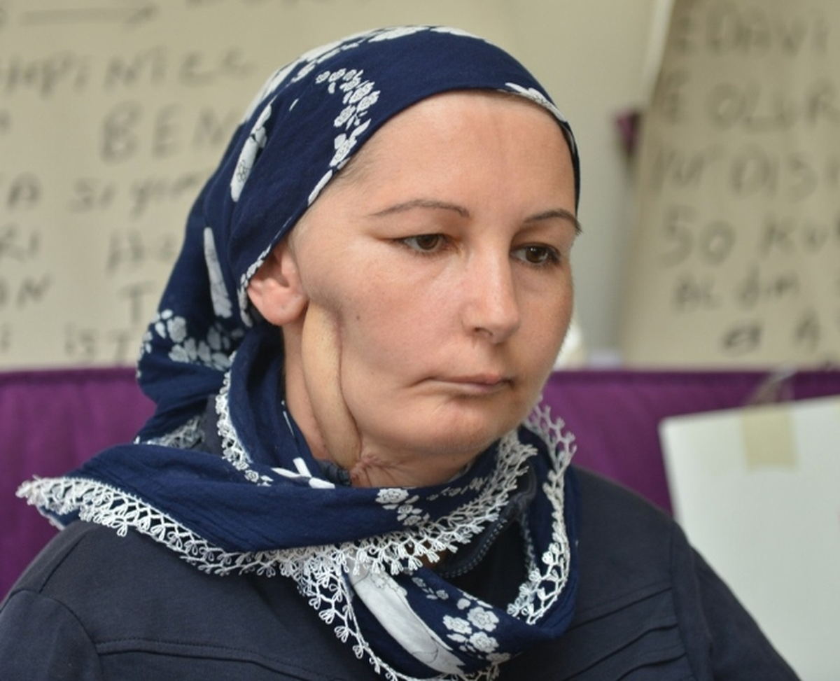 (Özel Haber) Tedavi Olmak İçin Başbakan\'dan Yardım İstedi