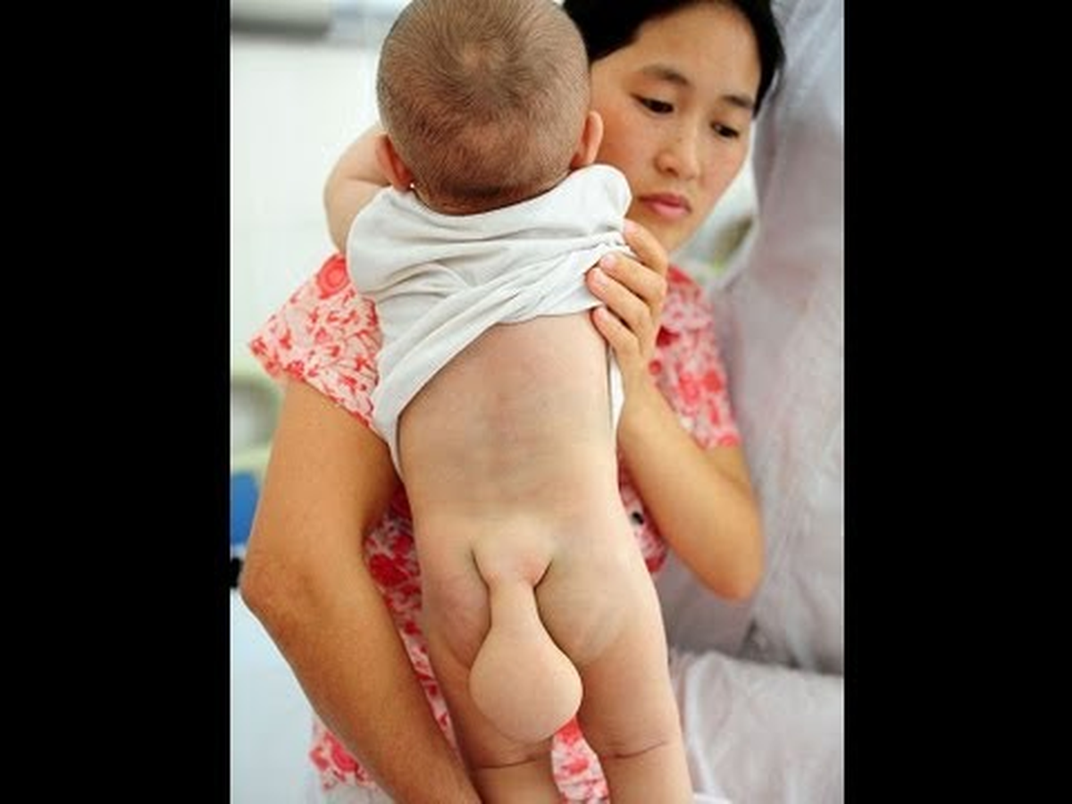 Kuyruklu Bebek Görenleri Şaşırtıyor