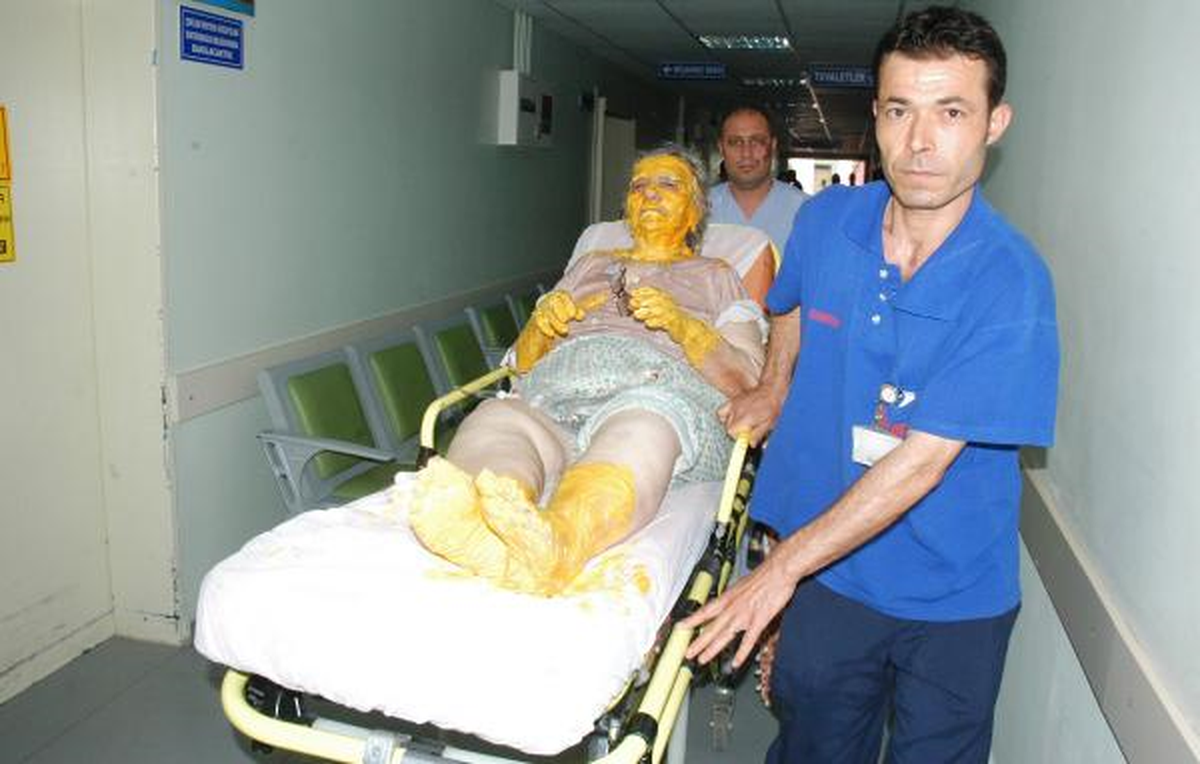 Ceyhan\'daki Tüp Patladı:2 Yaralı