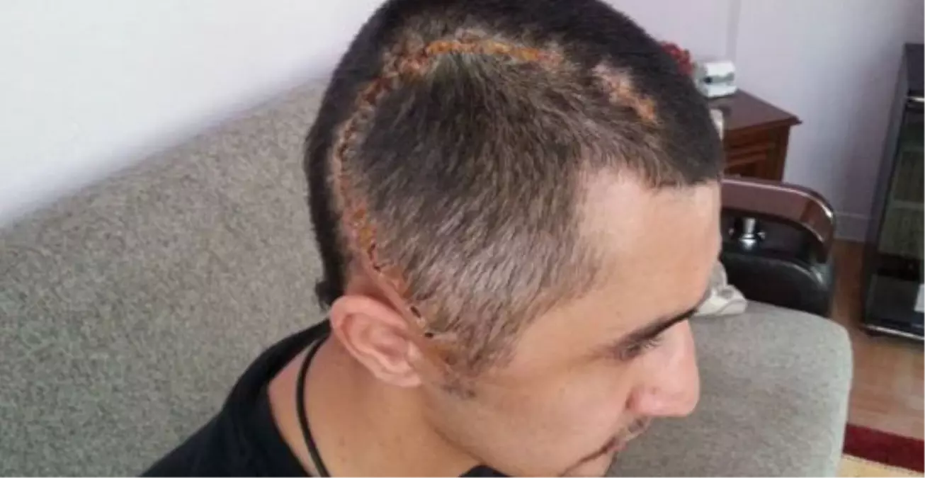 Gezi Olayları Ölüme Götürüyordu