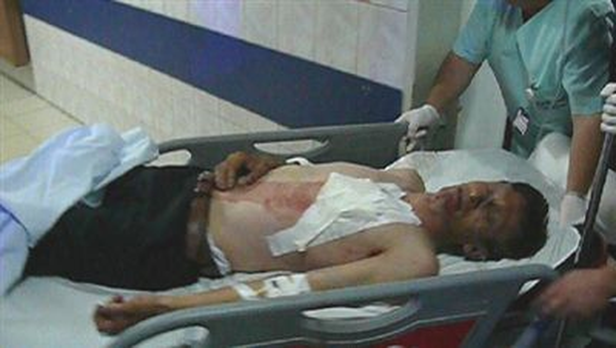 Düğün Sonrası Silahlı Kavga: 4 Yaralı