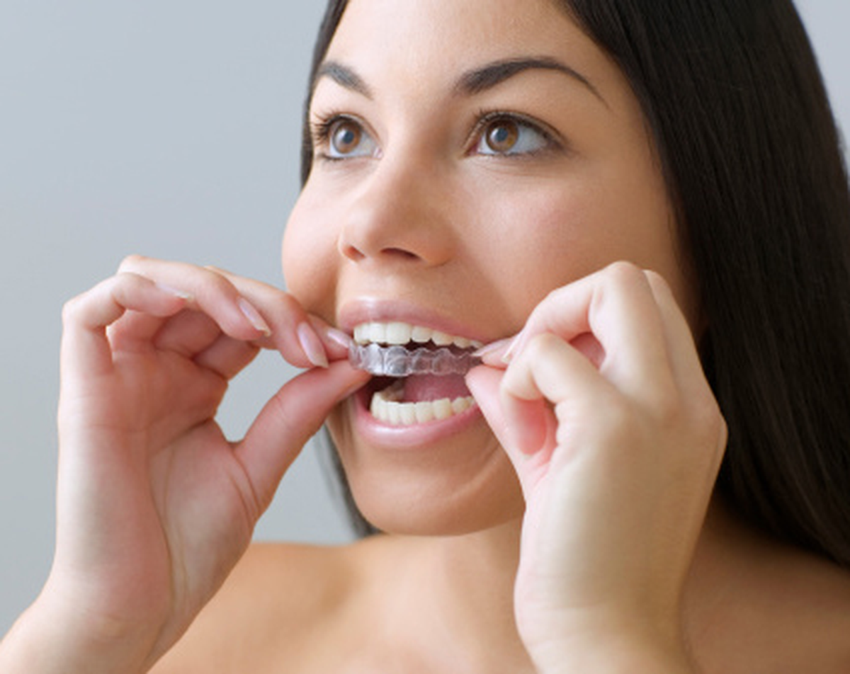 Evde Diş Beyazlatma Nasıl Yapılır?