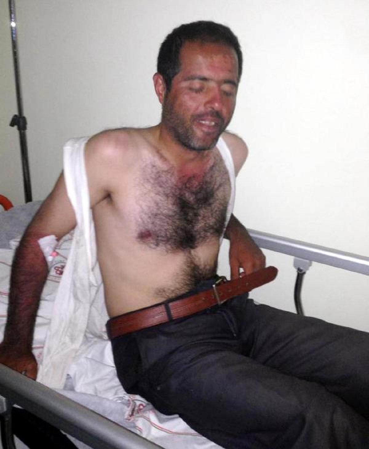 15 Gün Söğüt Yaprağı Yiyerek Hayatta Kaldı