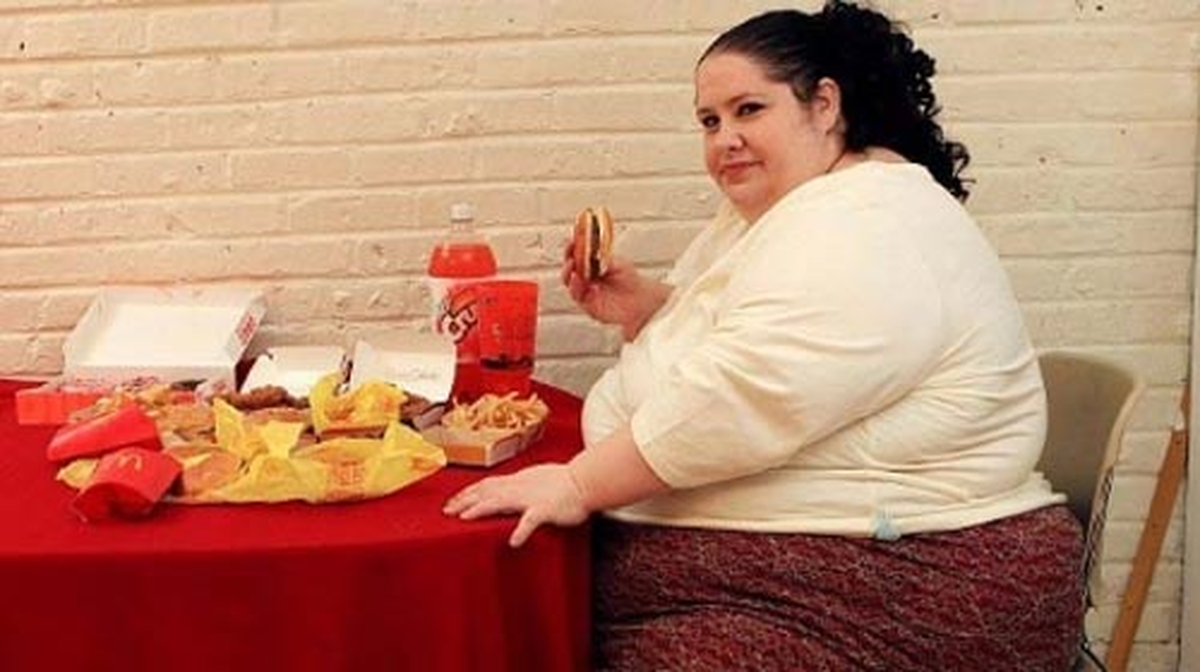 Obeziteye Dikkat
