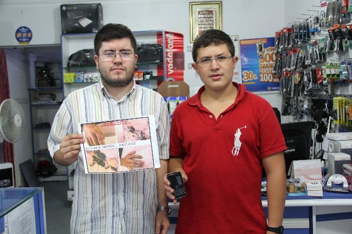 Cep Telefonu Bataryası Bomba Gibi Patladı