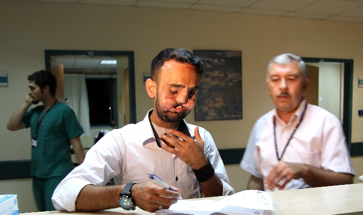 Yedi Saatlik Çift Çene ve Tam Yüz Nakil Operasyonu