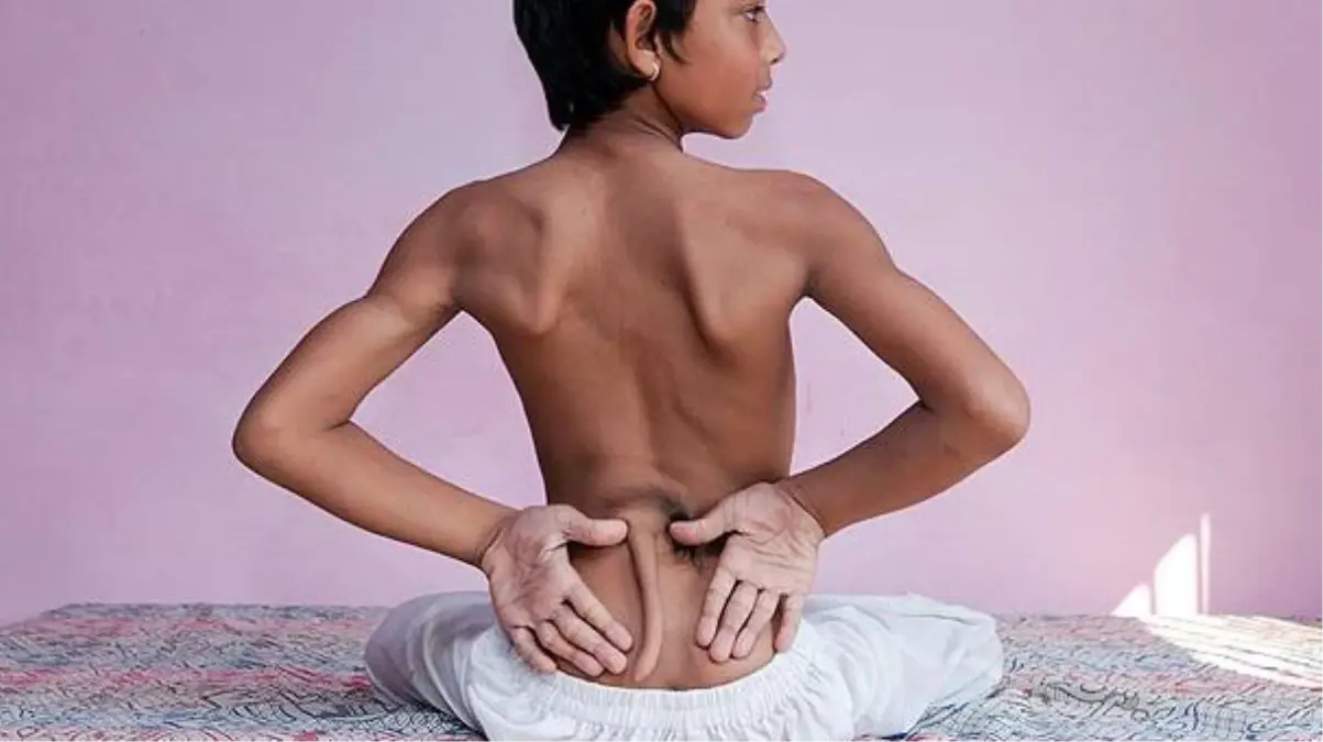 Hindistan'daki Kuyruklu Çocuk Görenleri Şaşırtıyor