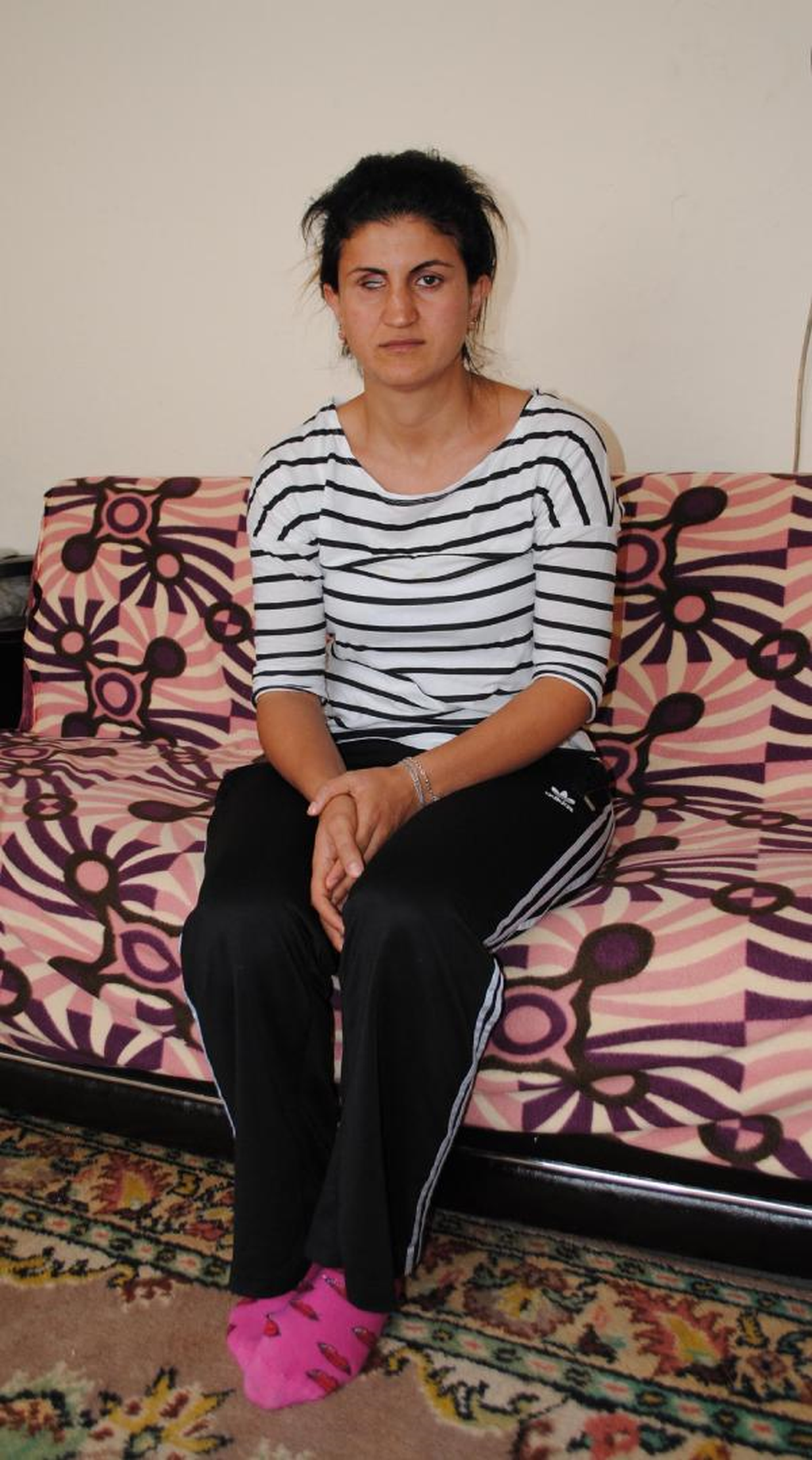 Semra'nın İsteği, Protez Bir Göz