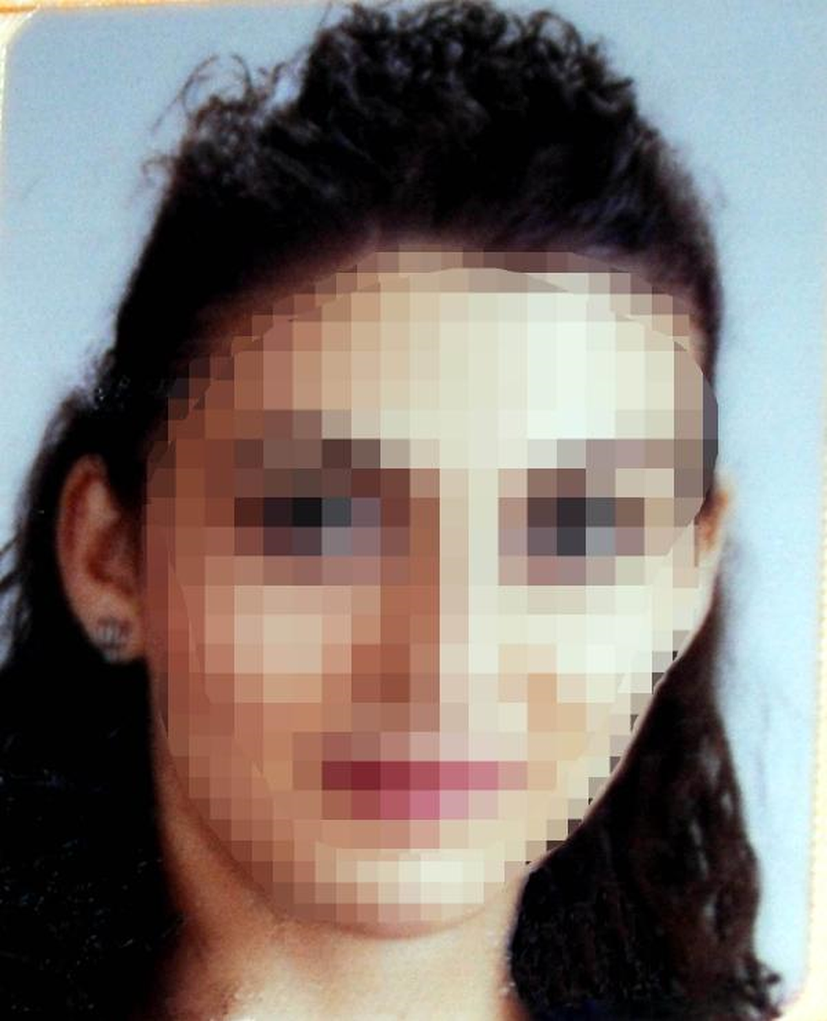 Eşi Terk Edince Kızının 2 Bacağını Kırdı