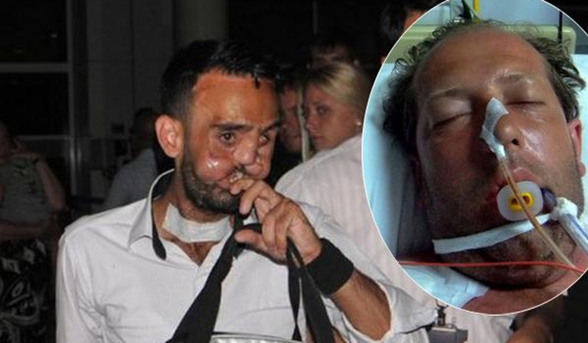 Türkiye'nin Beşinci Yüz Nakli