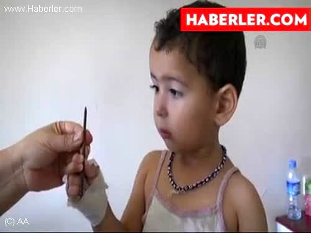 Kafatasındaki çivi ameliyatla çıkarıldı