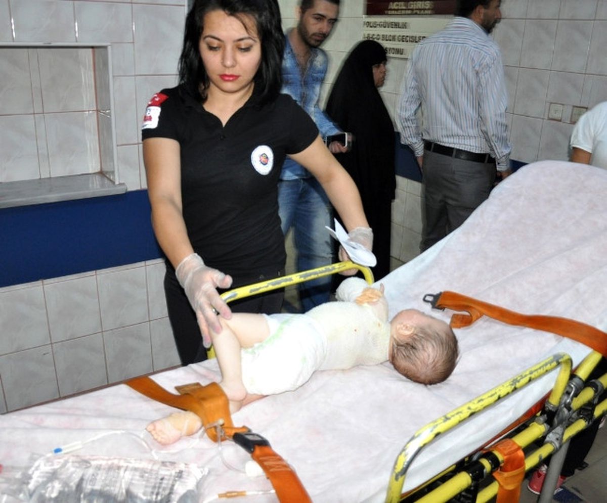 İnegöl\'de Dokuz Aylık Bebeğin Üzerine Kaynar Su Döküldü