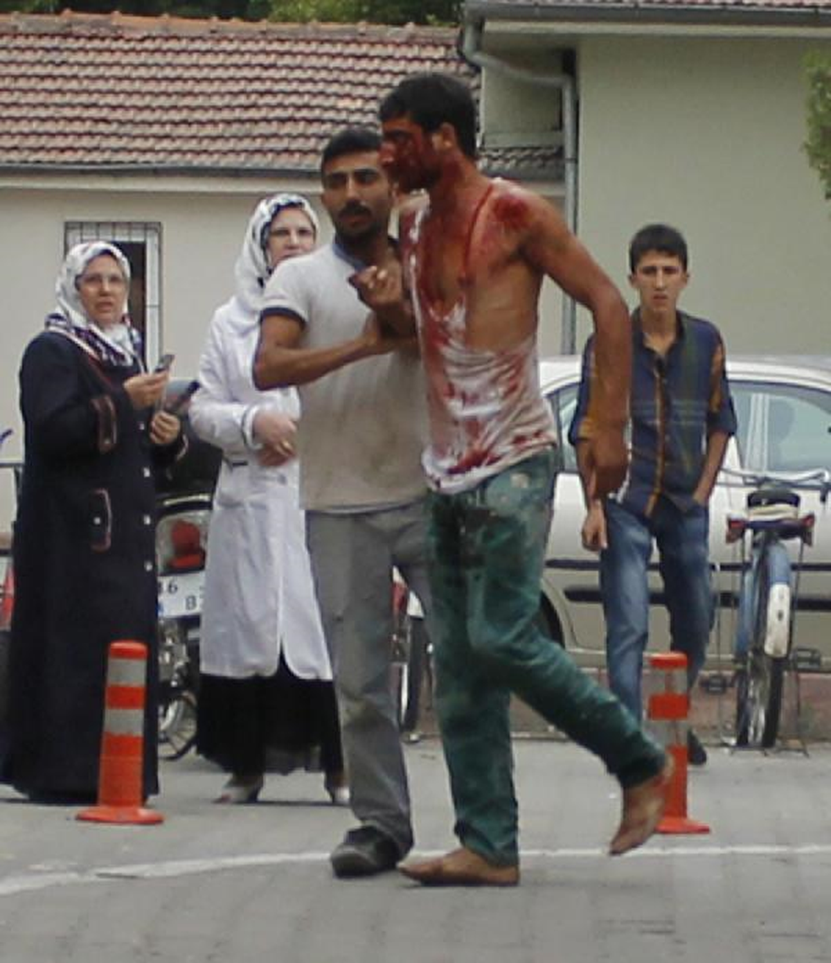 Kaza Sonrası Kavga