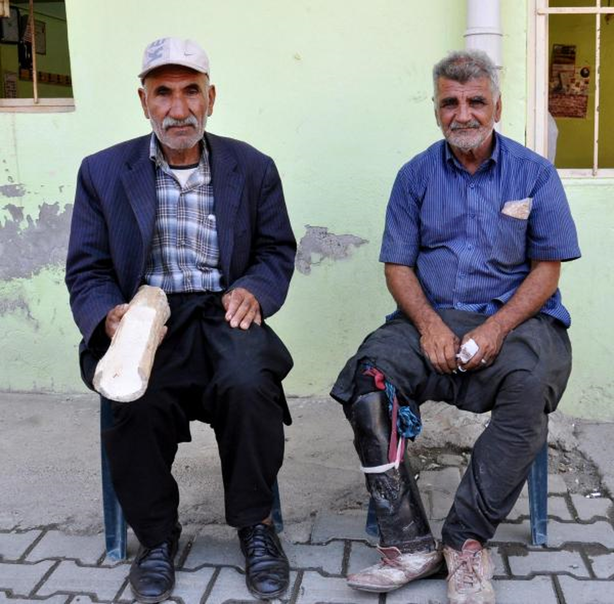 Kesik Ayağına Su Borusundan Protez Yaptı