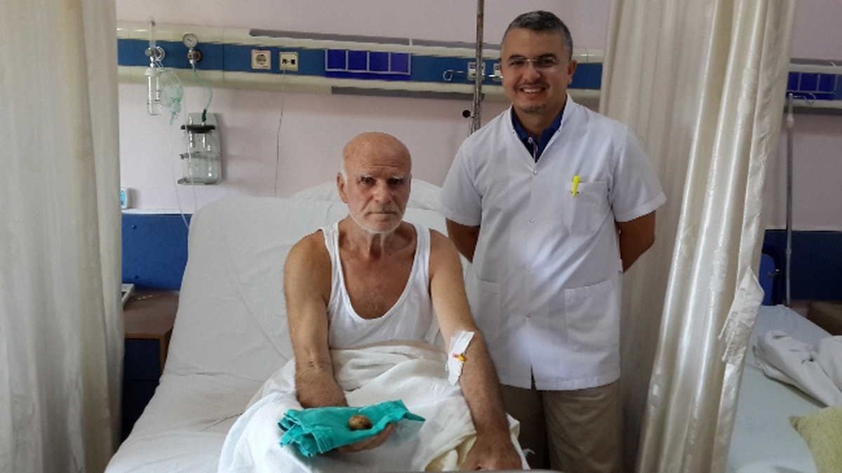 Mesanesinden Elma Büyüklüğünde Taş Çıktı