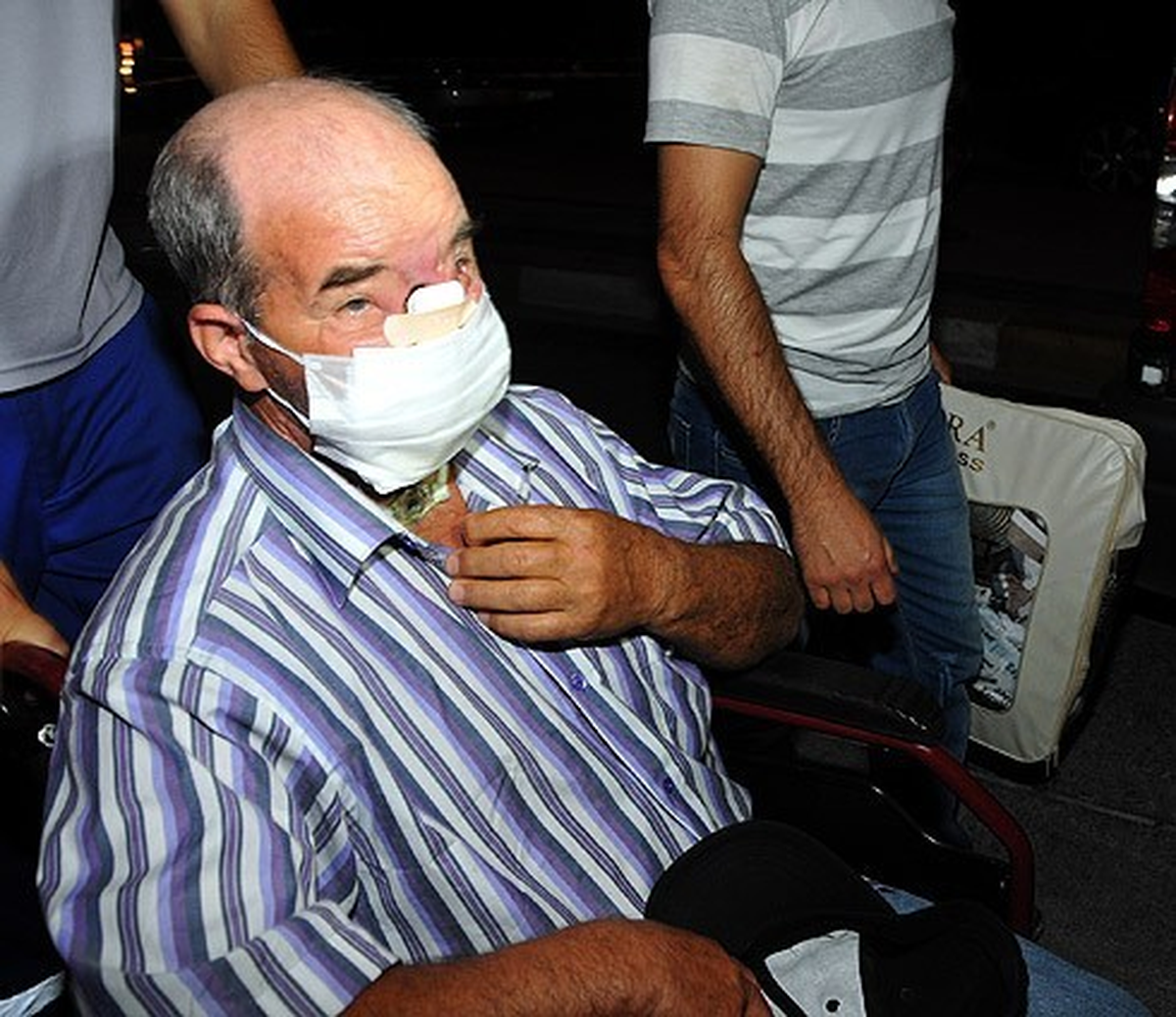 Sedat Üslün, Babasına Yapılan Yüz Nakli Operasyonunu Değerlendirdi
