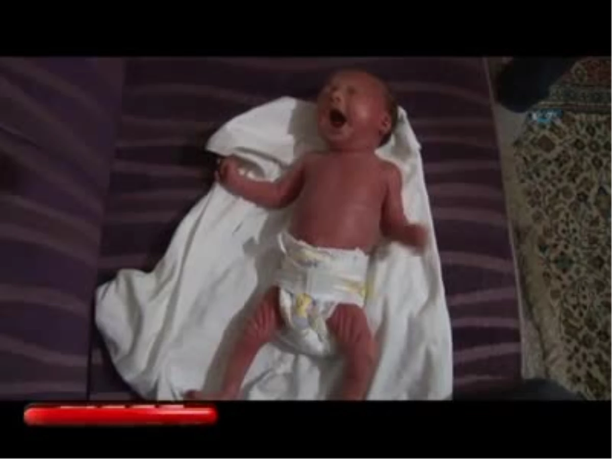 Türkiye\'ye Sığınan Afganlı Bebek "Balık Cildi" Hastası